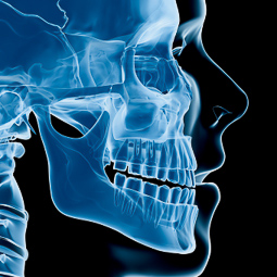 Bone Grafting - Athens Oral Surgery Center