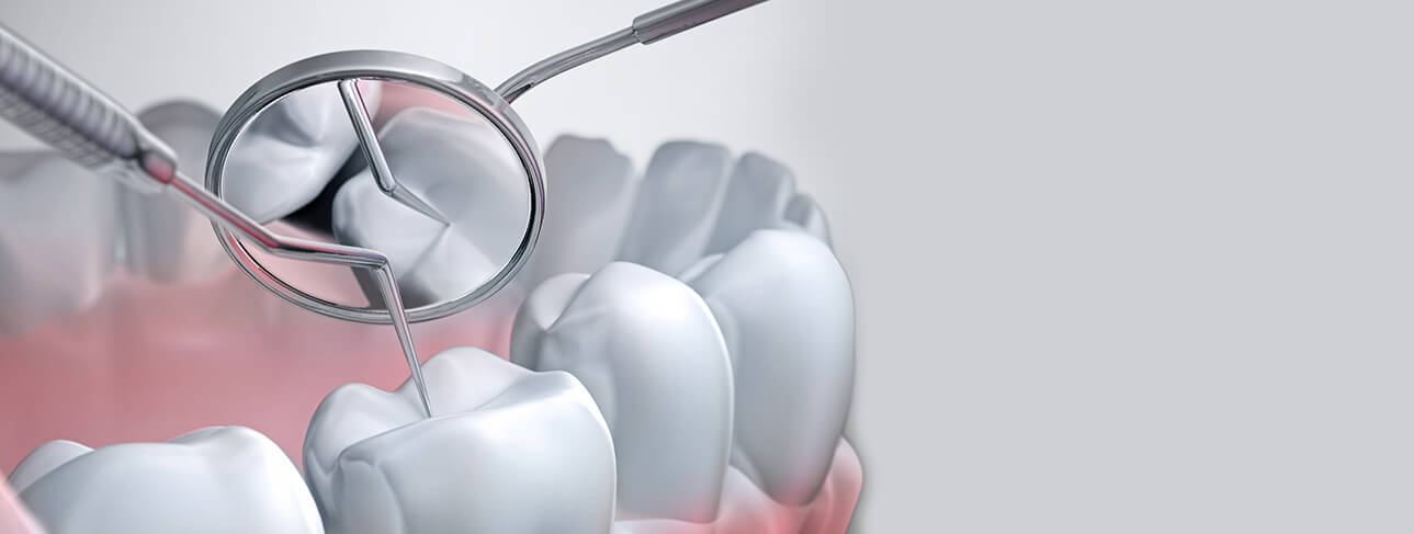 3d image of teeth being cleaned with a pick