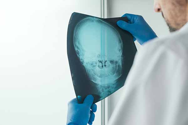 Doctor examining x-ray of the patient's skull in a medical clinic. Healthcare professional analyzing imaging test of human head.