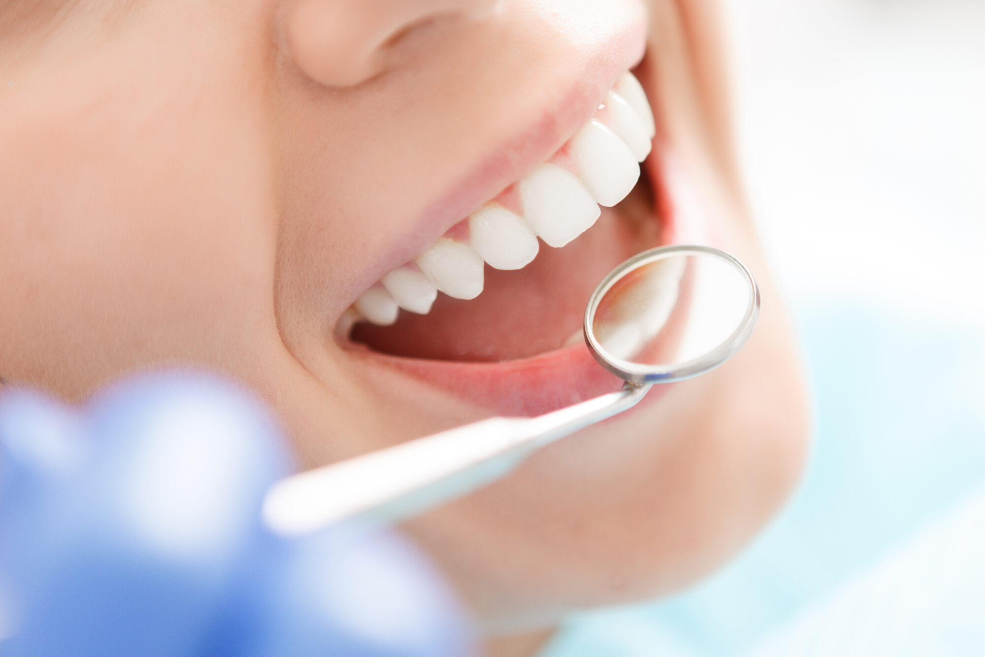 Close-up of woman having her teeth examined