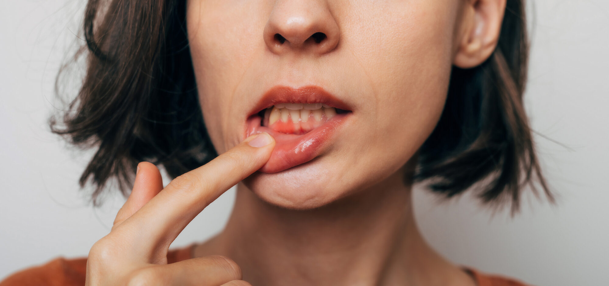 Close up shot of gum inflammation. Cropped shot of a young woman