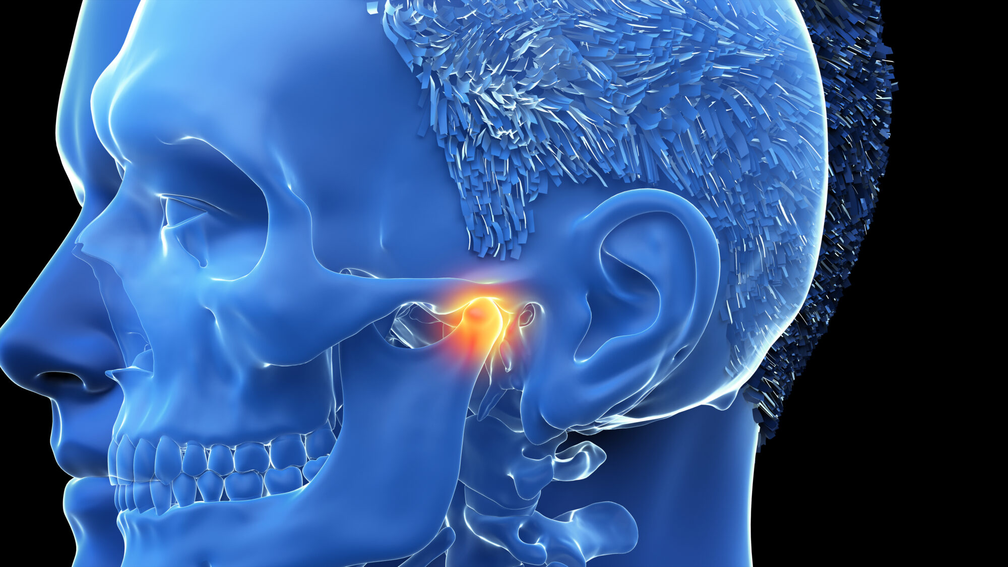 3d rendered illustration of a painful temporomandibular joint